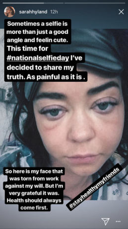 Mūsdienu ģimenes Sāra Hylands ir ievietots slimnīcā un dalās ar sāpīgu viņas pietūkušās sejas selfiju